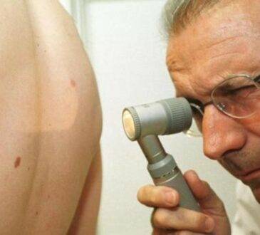 De acuerdo al diccionario de terminología de Ciencias Médicas, se define al tumor como: Tumefacción o hinchazón morbosa.