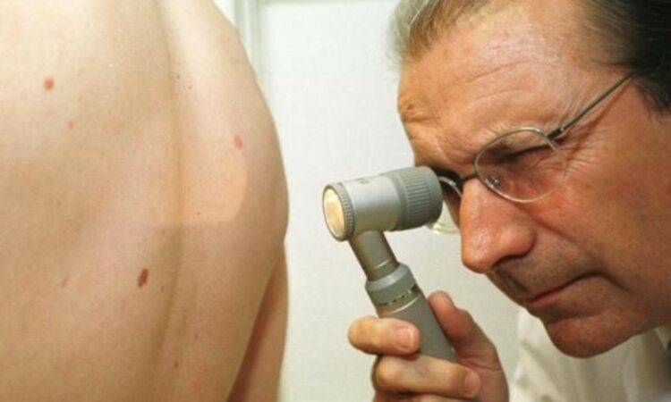 De acuerdo al diccionario de terminología de Ciencias Médicas, se define al tumor como: Tumefacción o hinchazón morbosa.