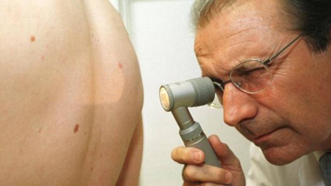 De acuerdo al diccionario de terminología de Ciencias Médicas, se define al tumor como: Tumefacción o hinchazón morbosa.