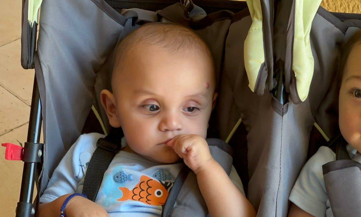 Ángel tiene nueve meses y le urge una operación.